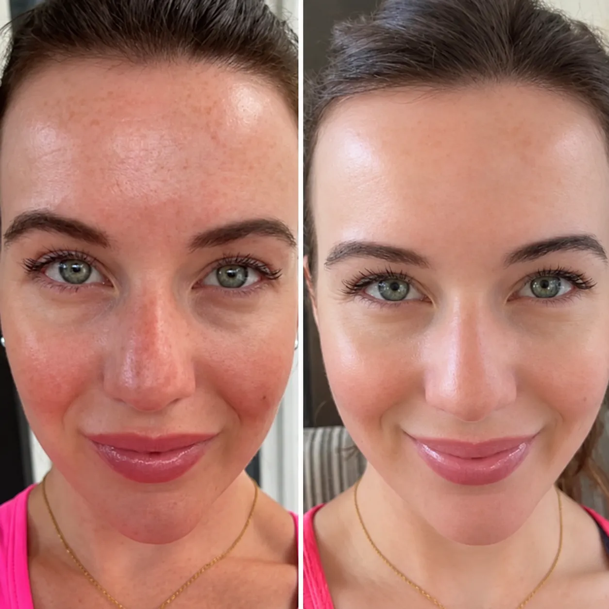 Máscara LED 7 Cores Fóton Terapia Antirrugas e Acne