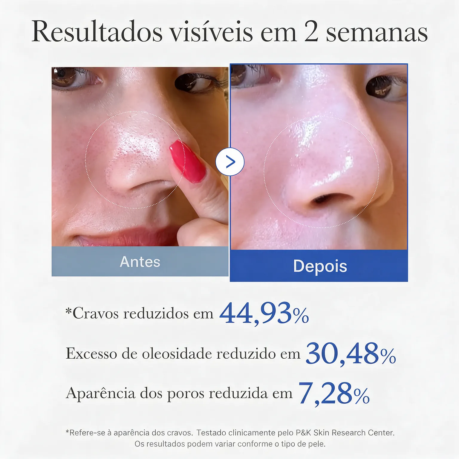 MEDICUBE Zero Pore Pad Tônico Facial 70 Unidades 155g