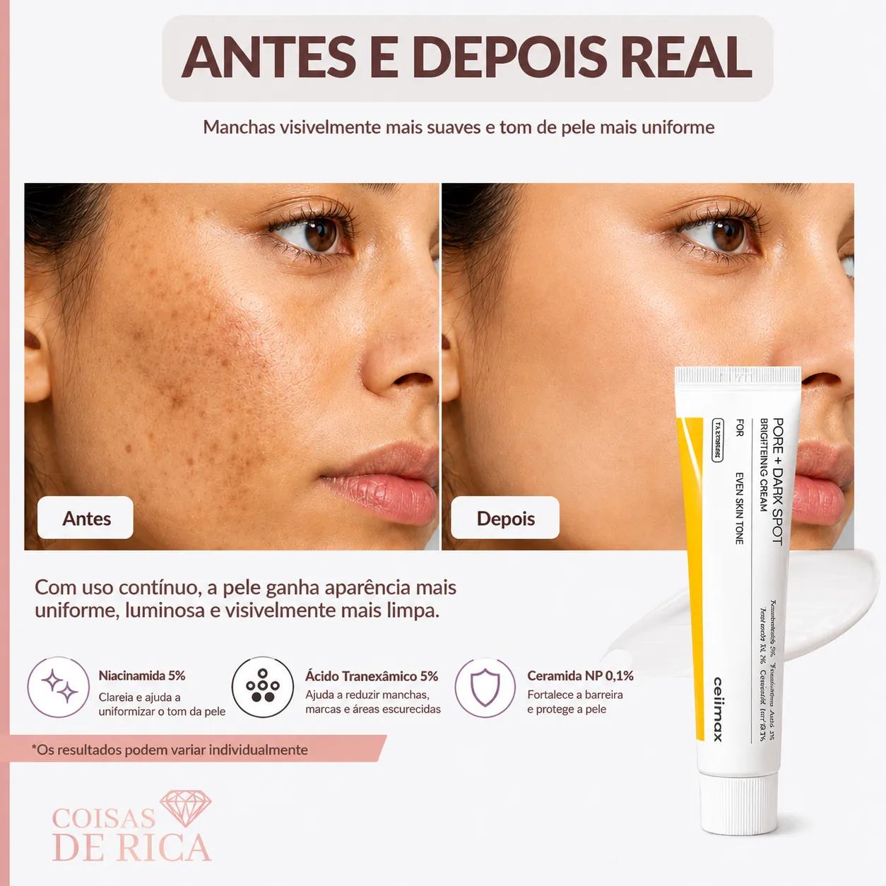 CELIMAX Creme Clareador Para Poros e Manchas Escuras 35ml