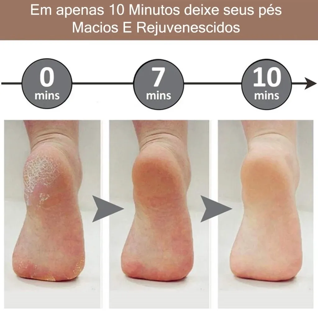 Lixador de Pés Elétrico Portátil 2 em 1 – Esfolia & Remove Calos