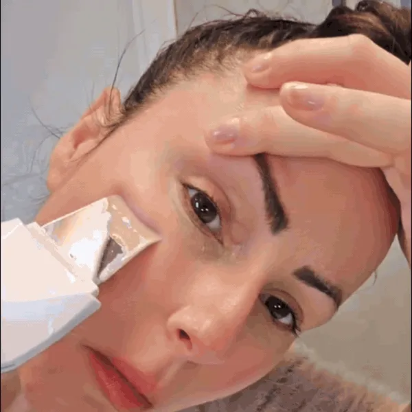 APARELHO PEELING ULTRASSÔNICO | LIMPEZA FACIAL PROFUNDA + REMOÇÃO DE CRAVOS
