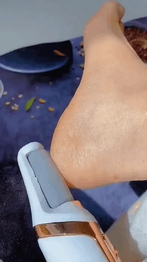 Lixador de Pé Elétrico - Esfoliador Tira Calos Pedicure Portátil