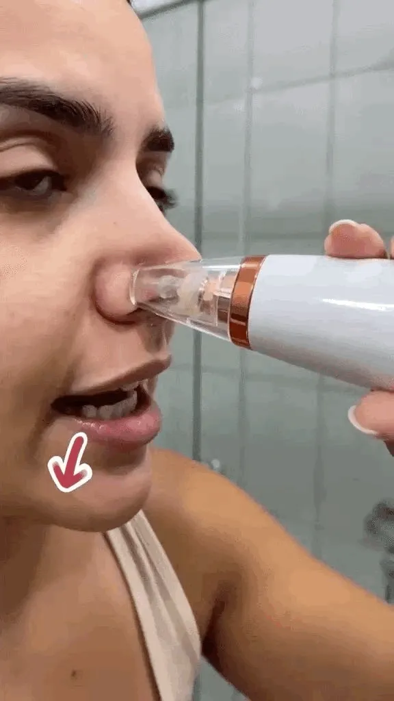 Removedor De Cravos Espinhas Cleaning Sugador Poros Acne Sucção Usb Recarregável