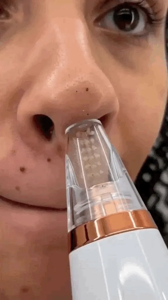 Removedor De Cravos Espinhas Cleaning Sugador Poros Acne Sucção Usb Recarregável